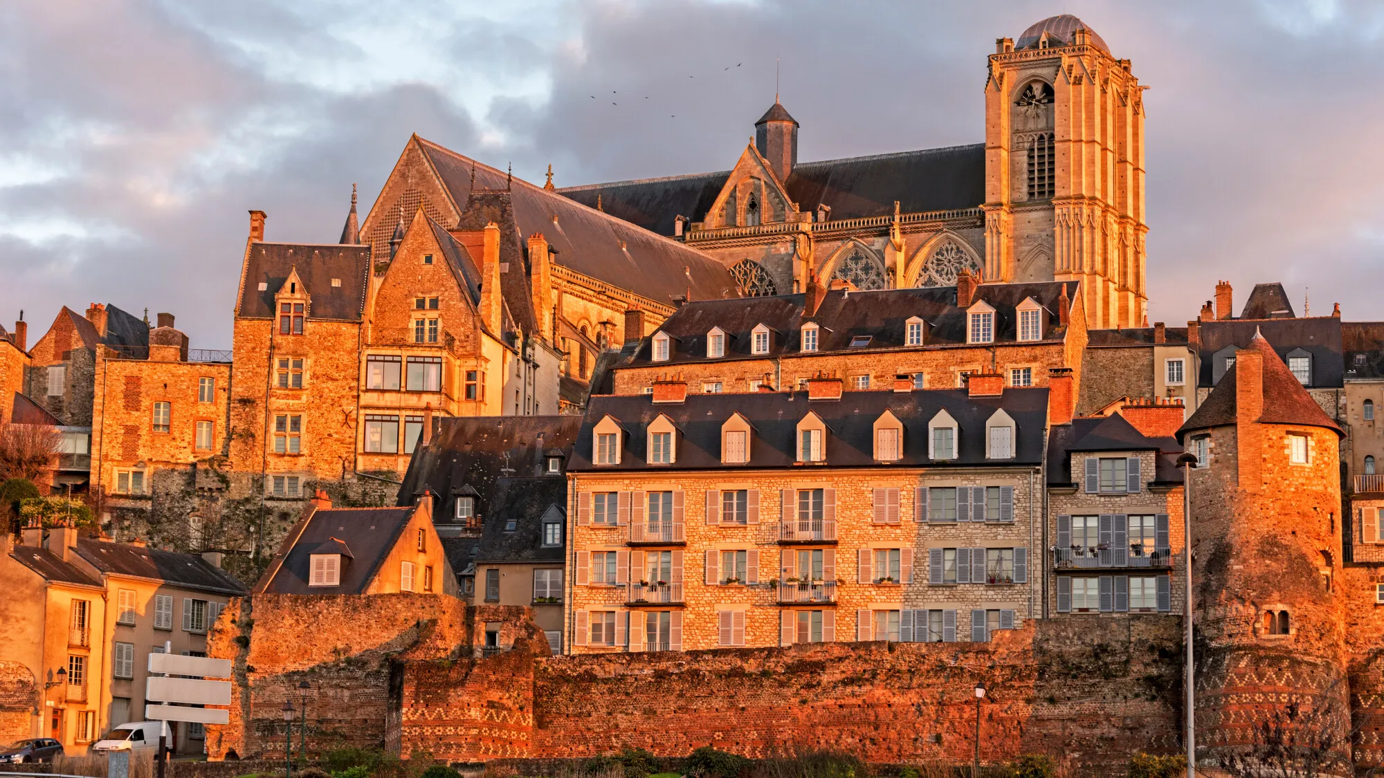 Le Mans - opération laser des yeux et chirurgie réfractive